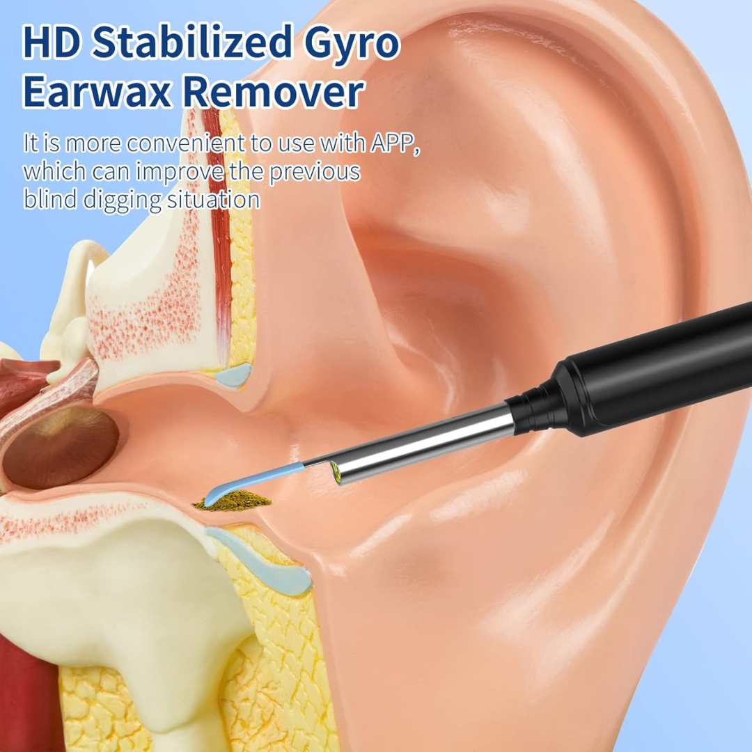 Limpiador de Oídos con Cámara