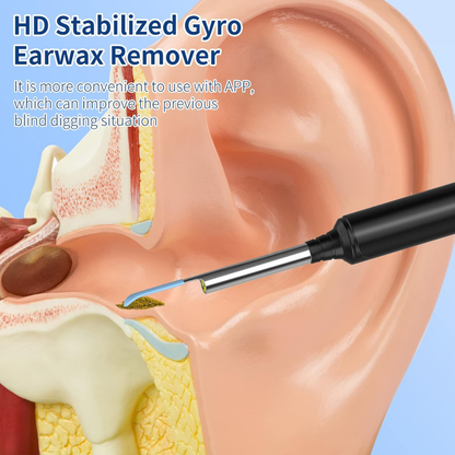 Limpiador de Oídos con Cámara